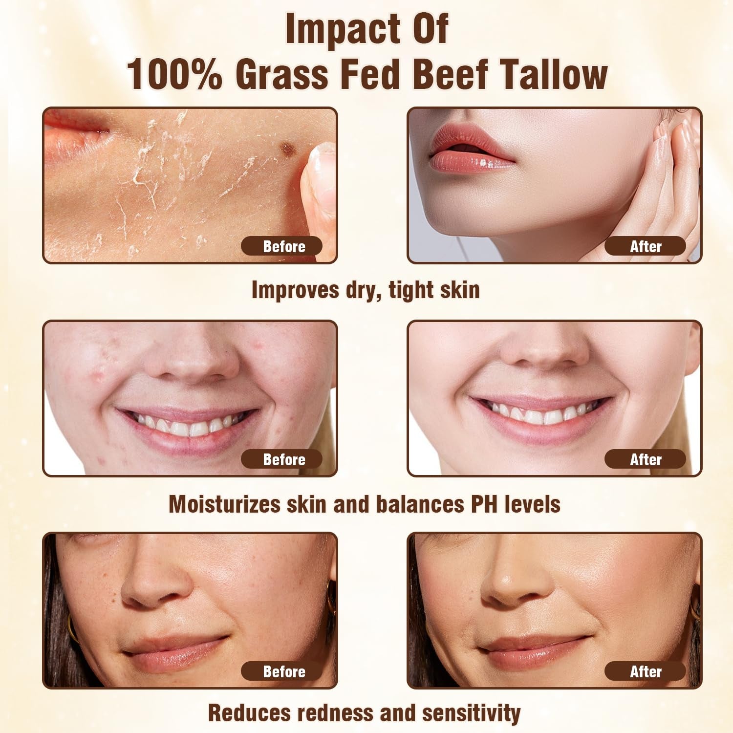 Beef Tallow for Skin, Tallow and Honey Balm, Natural Moisturizer Body Cream, Natural Organic Grass Fed Beef Tallow for Body Moisturizer Skin Care for Sensitive Skin